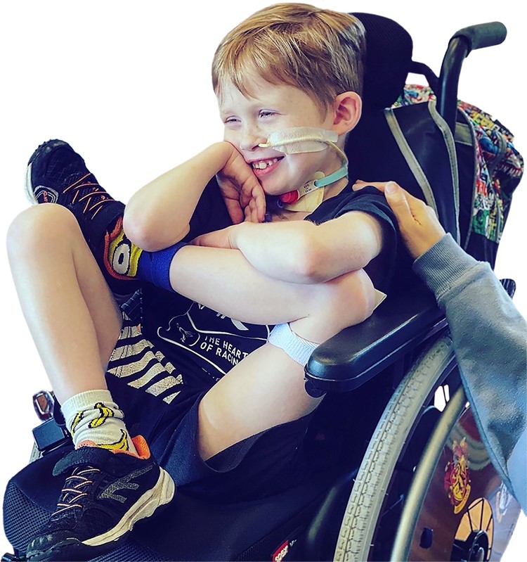 Markus, a nine year old boy in a wheelchair, with a nasogastric tube.
