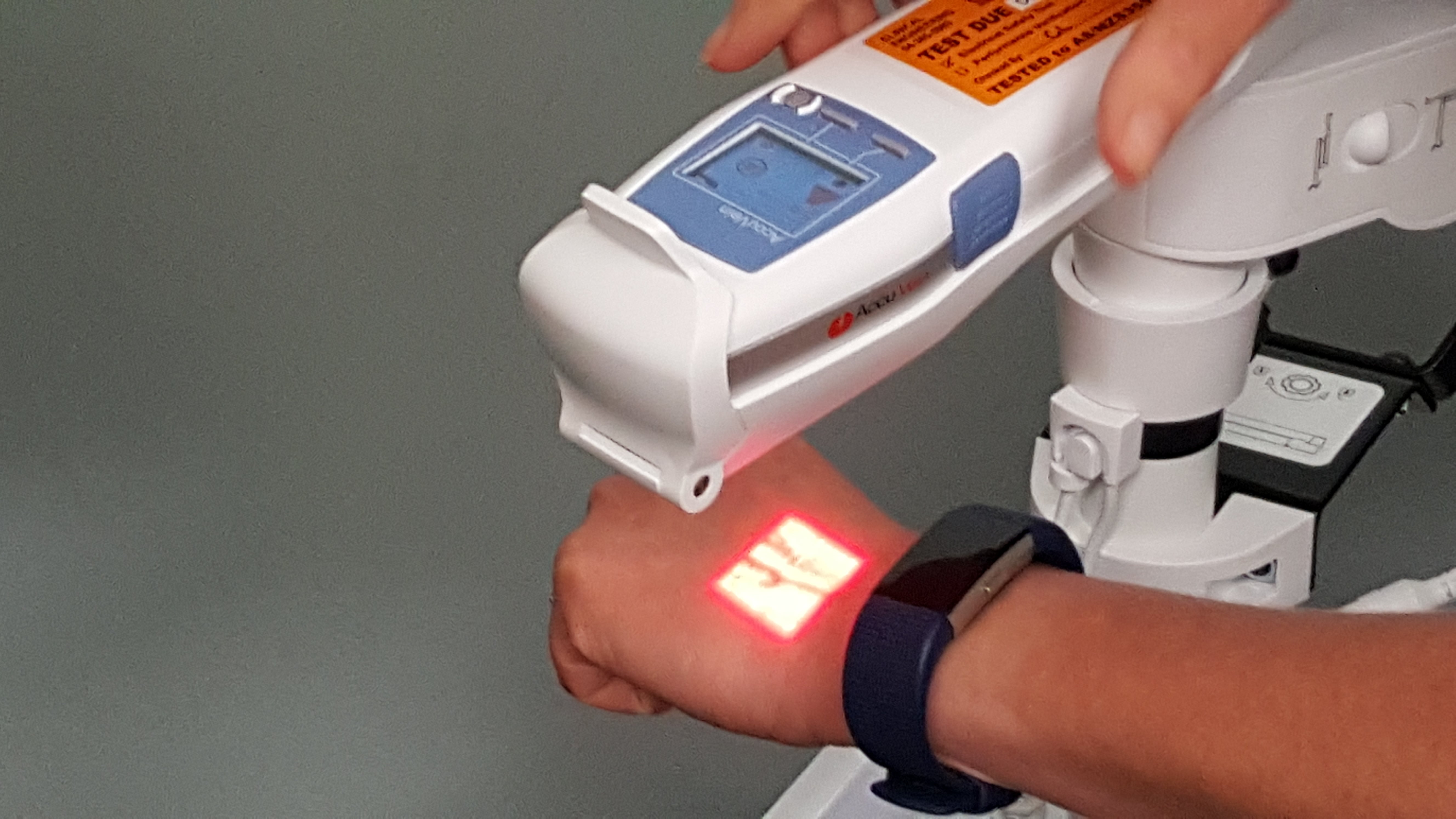 The AccuVein device in action!